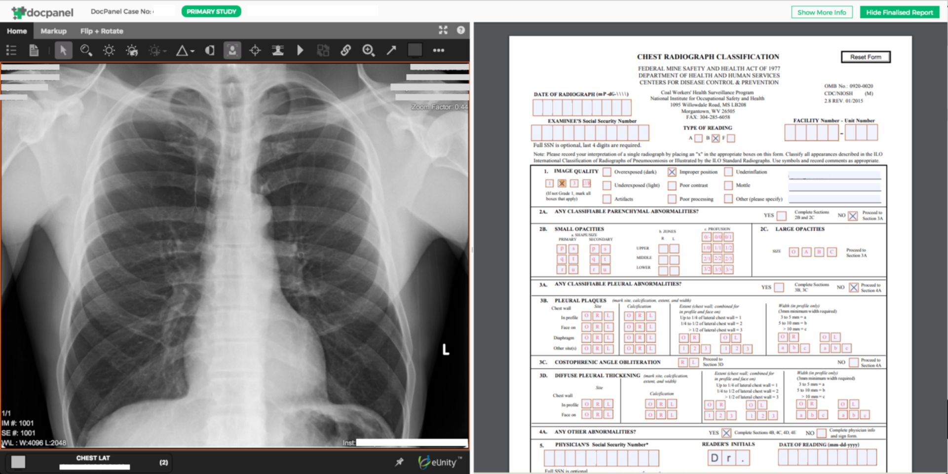 NIOSH “B Reading” is now online and efficient with DocPanel 1